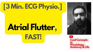 How to Spot Atrial Flutter on ECG, FAST? | Sawtooth| #ECGInterpretation #EKGTutorial #LearnECG