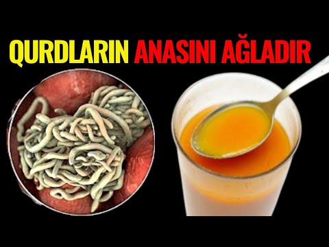 Bağırsaq qurdlarından xilas olmağın yolu