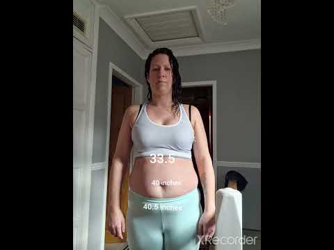 Endometrial Ablation Weight Gain 80