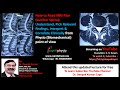 How to Read MRI Film of Spine, Understand, Pick Relevant Findings, Interpret & Correlate Clinically