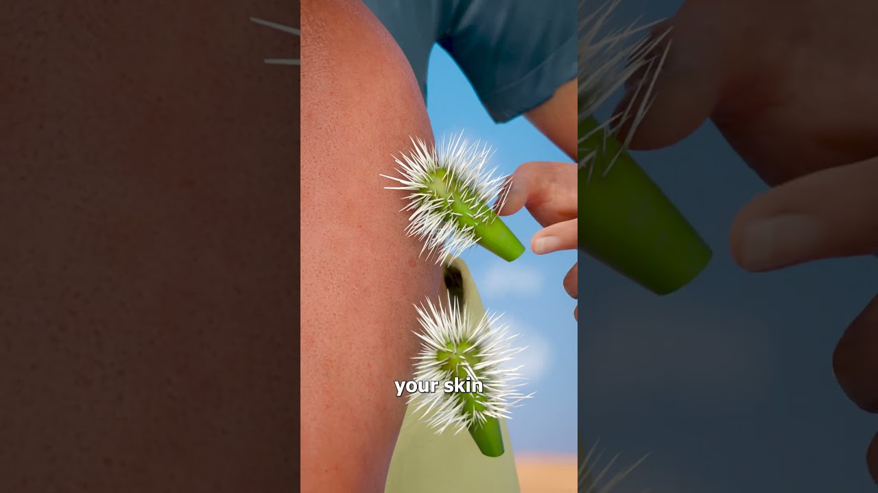 How To Remove Cholla Cactus Spines π€π΅