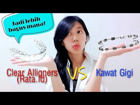 Kawat Gigi Atau Clear Aligners Rata  Id  VS  behel 