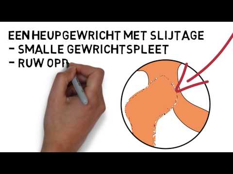 Video: Hoe Hurken? Effecten Van Verschillende Standbreedtes, Voetplaatsingshoeken En Ervaringsniveau Op Knie-, Heup- En Rompbeweging En Belasting