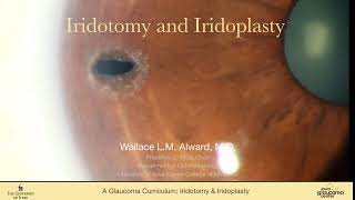Iridotomy and Iridoplasty