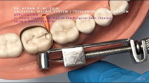 Universal (Tofflemire) matrix system (2) application & removal overview - Arabic عربي