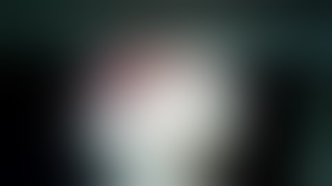 Open Pyelolithotomy and endoscopic stone retrieval