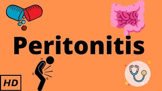 Peritonitis, Causes, Signs and Symptoms, Diagnosis and Treatment.