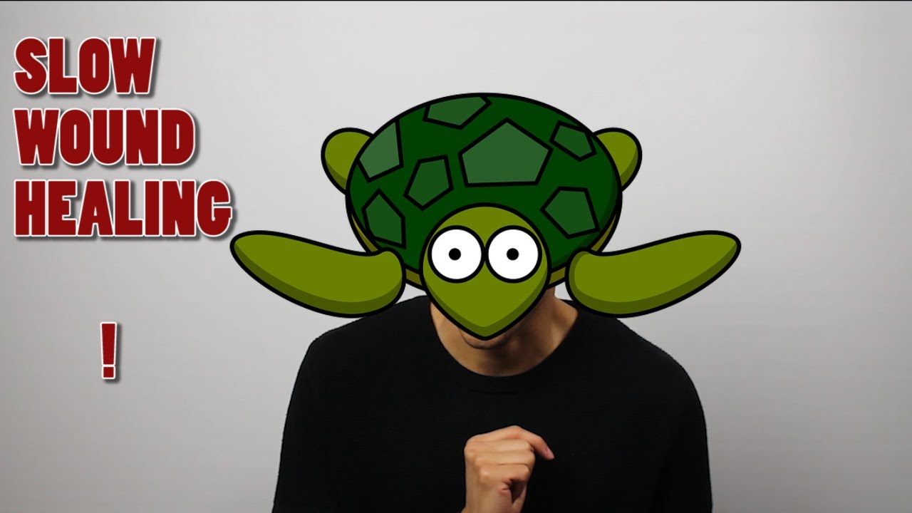 Homeostasis disruption (Glucose control example)  شرح بالعربي