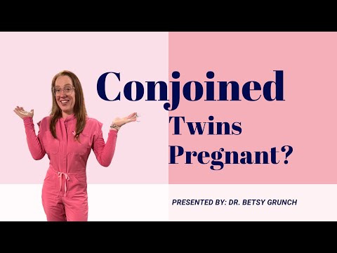 Neuroanatomy and pregnant rumors of Conjoined twins Brittany and Abby Hensel EXPLAINED