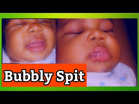 Why Baby Bubbly Spit up| spit up | spit bubbles |baby vomit |baby spit up remedy |how to reduce baby