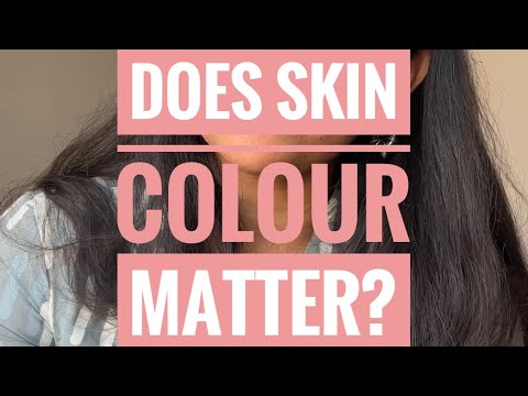 Fair or dark! Does baby’s skin colour matter?!