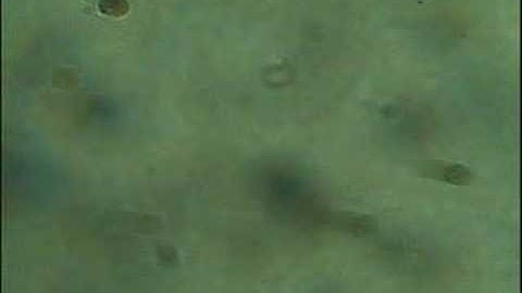 mushroom spores under microscope