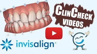 Invisalign ClinCheck Videos For Various Teeth Conditions