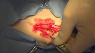 Spaying a big dog: ovaro-hysterectomy by Greg Martinez DVM 118,940 views 8 years ago 34 minutes