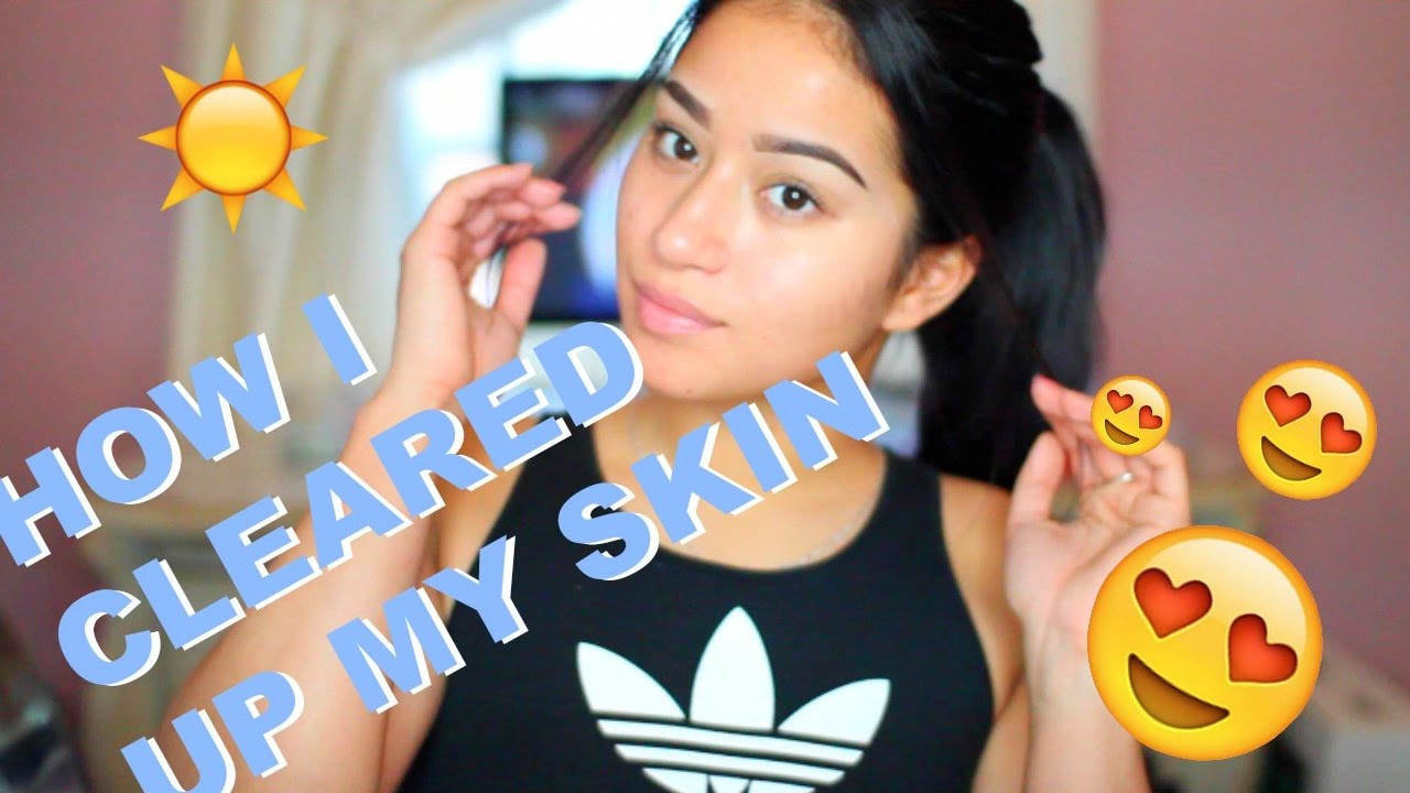 HOW I CLEARED UP MY SKIN!!!!! - YouTube