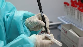 Covid-19 testing capacity under strain: Quest Diagnostics Profile