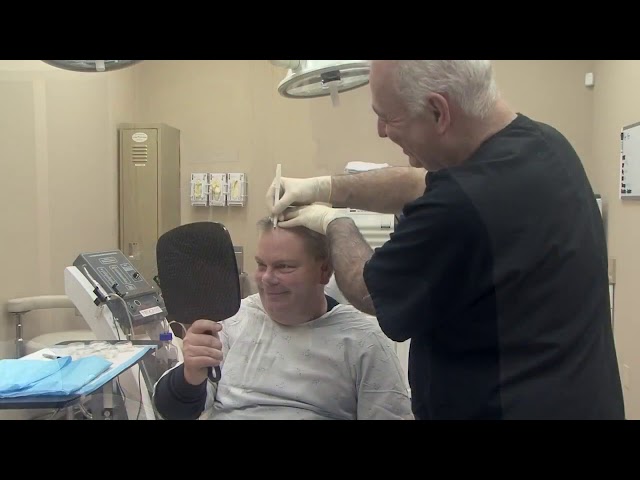 Restoring Your Hairline with Dr  Michael Vories of Carolina Hair Surgery   Charlotte, NC