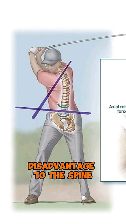 LOW BACK PAIN IN GOLFERS