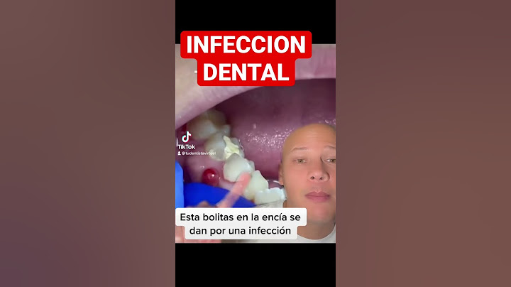 ESTAS BOLITAS SIGNIFICAN INFECCION, las tienes?