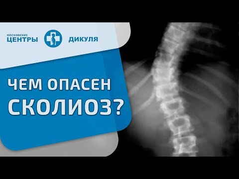 Интервью. Можно ли вылечить сколиоз?