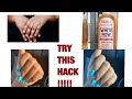 HOW TO PROPERLY GET RID OF YOUR KNUCKLES|BEST HACK FOR KNUCKLES| #skincare #knuckles #whitenowoil