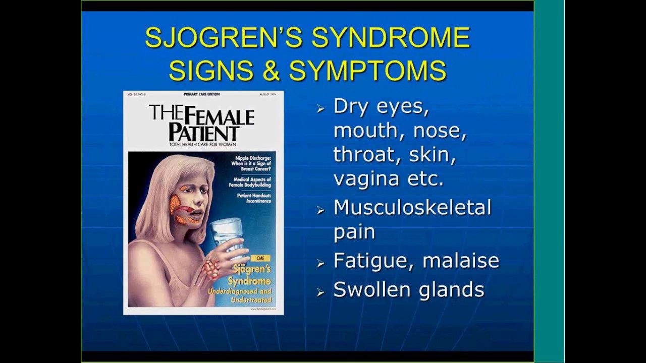 Sjögren-szindróma tünetei és kezelése - HáziPatika