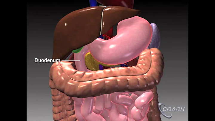 The Whipple Procedure