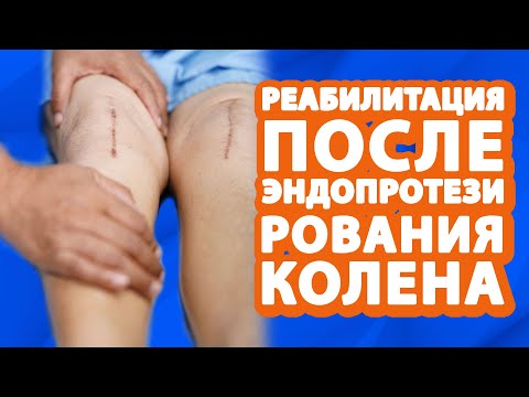 Коленный сустав // Реабилитация после эндопротезирования коленного сустава #клиниказдравствуй