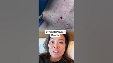 Interesting She Used A Skin Hook In This Way 