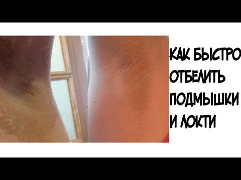 Как БЫСТРО отбелить подмышки и локти///Эффективное средство