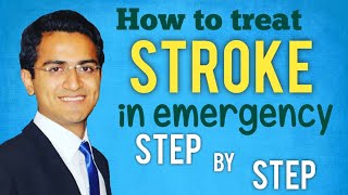 Emergency Treatment For Stroke - Investigations,Types, Long-Term Management, Stroke Medicine Lecture