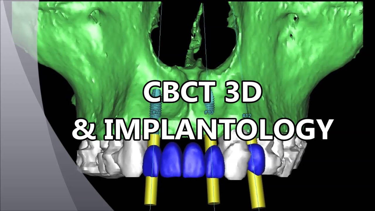 CBCT Course in Bahrain, 3D Imaging in Dentistry, YouTube
