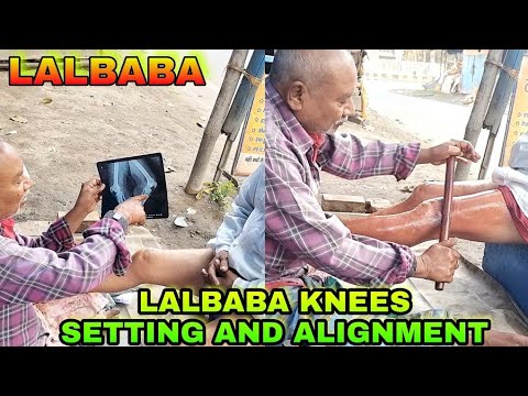 Indian Barber,LalBaba Foot Massage, knee Alignment And Bone Setting With smoke Oil Very Satisfing 😴