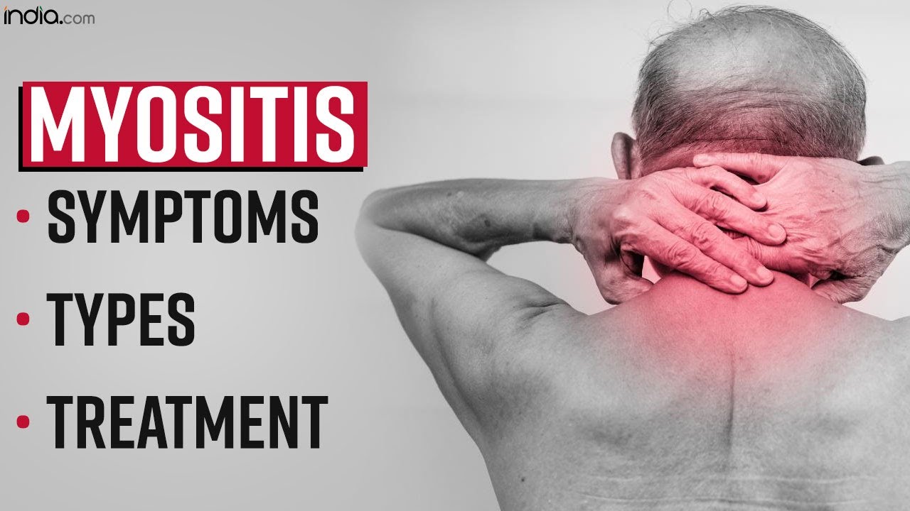 What is Myositis? Know What It Is, Symptoms, Types And Treatment |  Samanatha Ruth Prabhu - YouTube