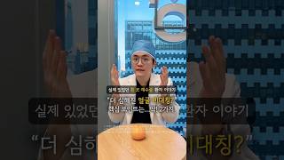 코성형 후 얼굴 비대칭이 심해진 환자 이야기 #코재수술 #코재수술후기 #코재수술전후