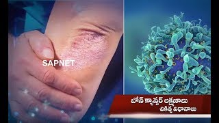 Health Guide | Bone Cancer - Symptoms and Causes | EP 52 | AP Prime Tv | SAPNET screenshot 5