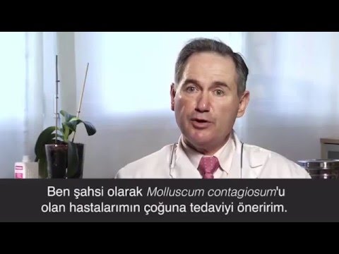 Video: Yumuşakça Contagiosum Nasıl Tedavi Edilir