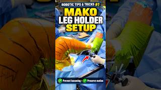 Mako Robotic Tips & Tricks #1: How to Set Up the Total Knee Leg Holder Correctly