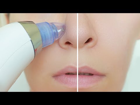 Video: 4 modi efficaci per pulire i pori ostruiti