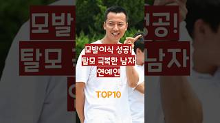 모발이식 성공! 탈모 극복한 남자 연예인 TOP10