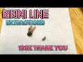 100k how to get rid of ingrown hairs on bikini line expert tips and techniques for smooth skin