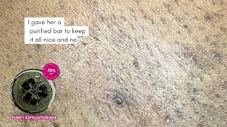 100k‼️ How to Get Rid of Ingrown Hairs on Bikini Line: Expert Tips and Techniques for Smooth Skin