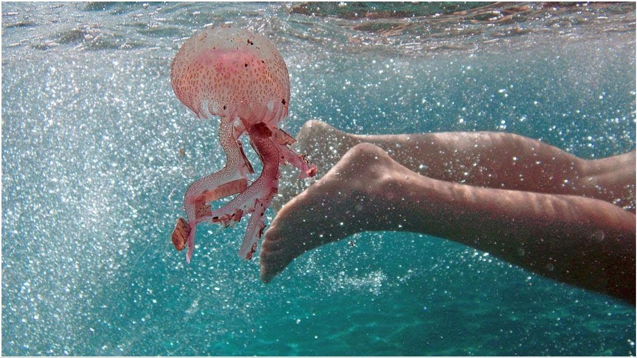Qué hacer cuando te pica una medusa