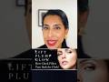 Cheek Fillers – Sculpt Your Ogee Curve, Lift Your Whole Look 💫