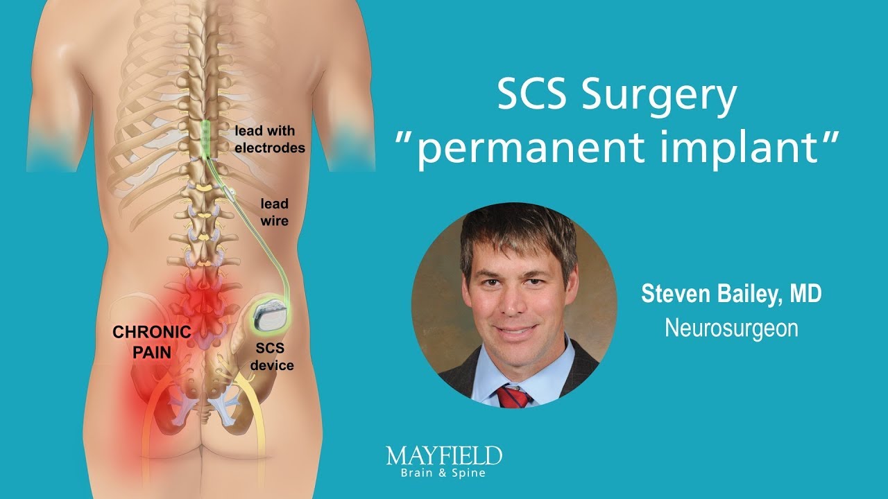 HF10 Spinal Cord Stimulation: Part 2 Surgery - YouTube