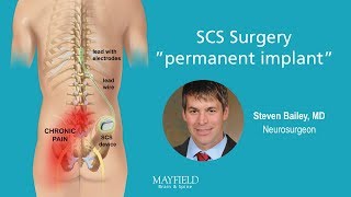 HF10 Spinal Cord Stimulation: Part 2 Surgery
