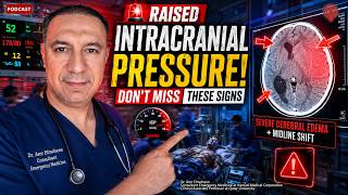 Raised Intracranial Pressure: The Emergency Every Doctor Must Recognize Before It's Too Late! 🧠⚠️