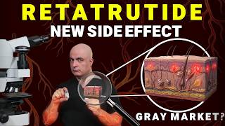 Next Ozempic? Retatrutide's Unknown Skin Effect (Pathologist Explains)