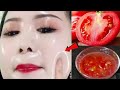 Skin Whitening Tomato Facial | Get Fair, Glowing, Spotless Skin Permanently