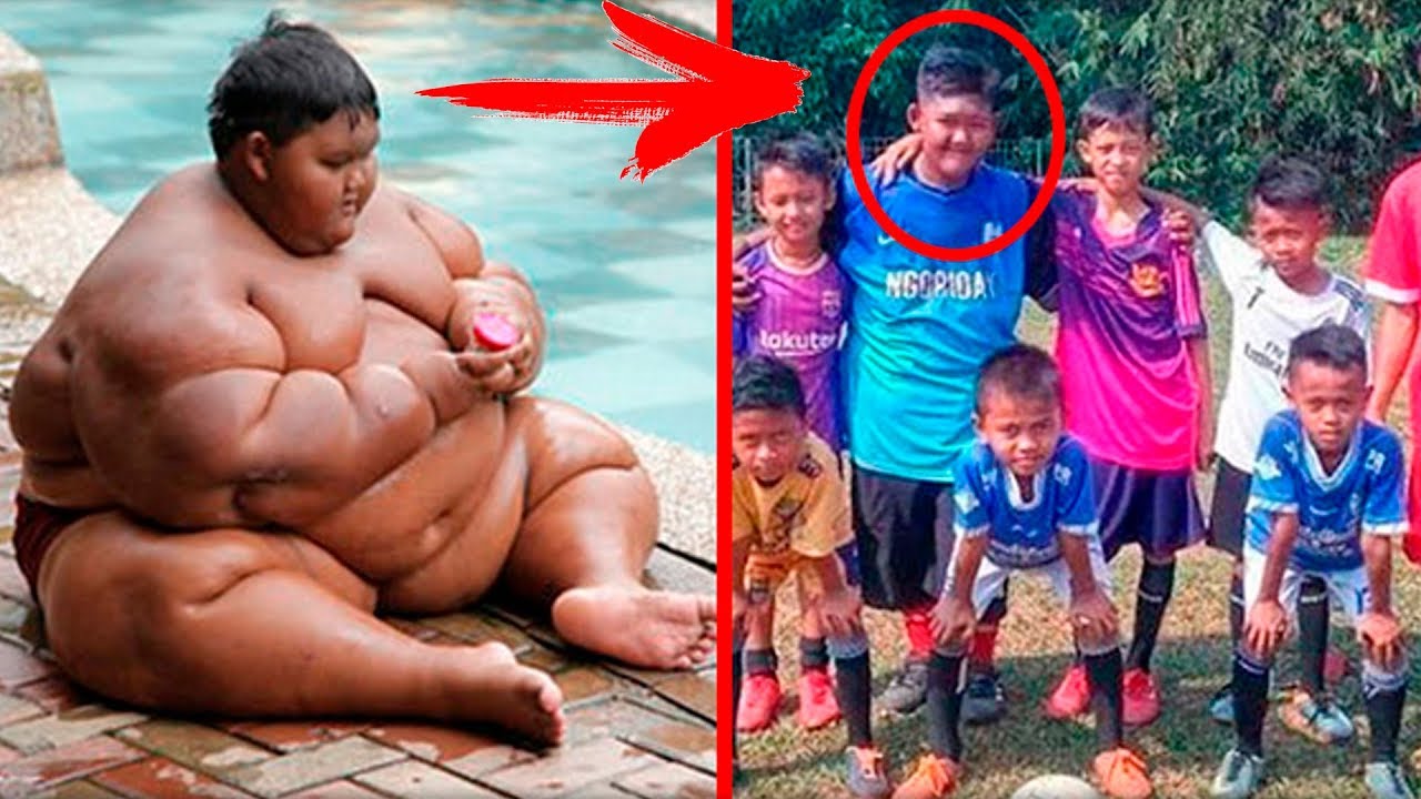 Мальчик 11 лет похудел. Самый толстый мальчик в мире Арья Пермана. Арья самый толстый мальчик. Самый толстый ребёнок в мире Арья.